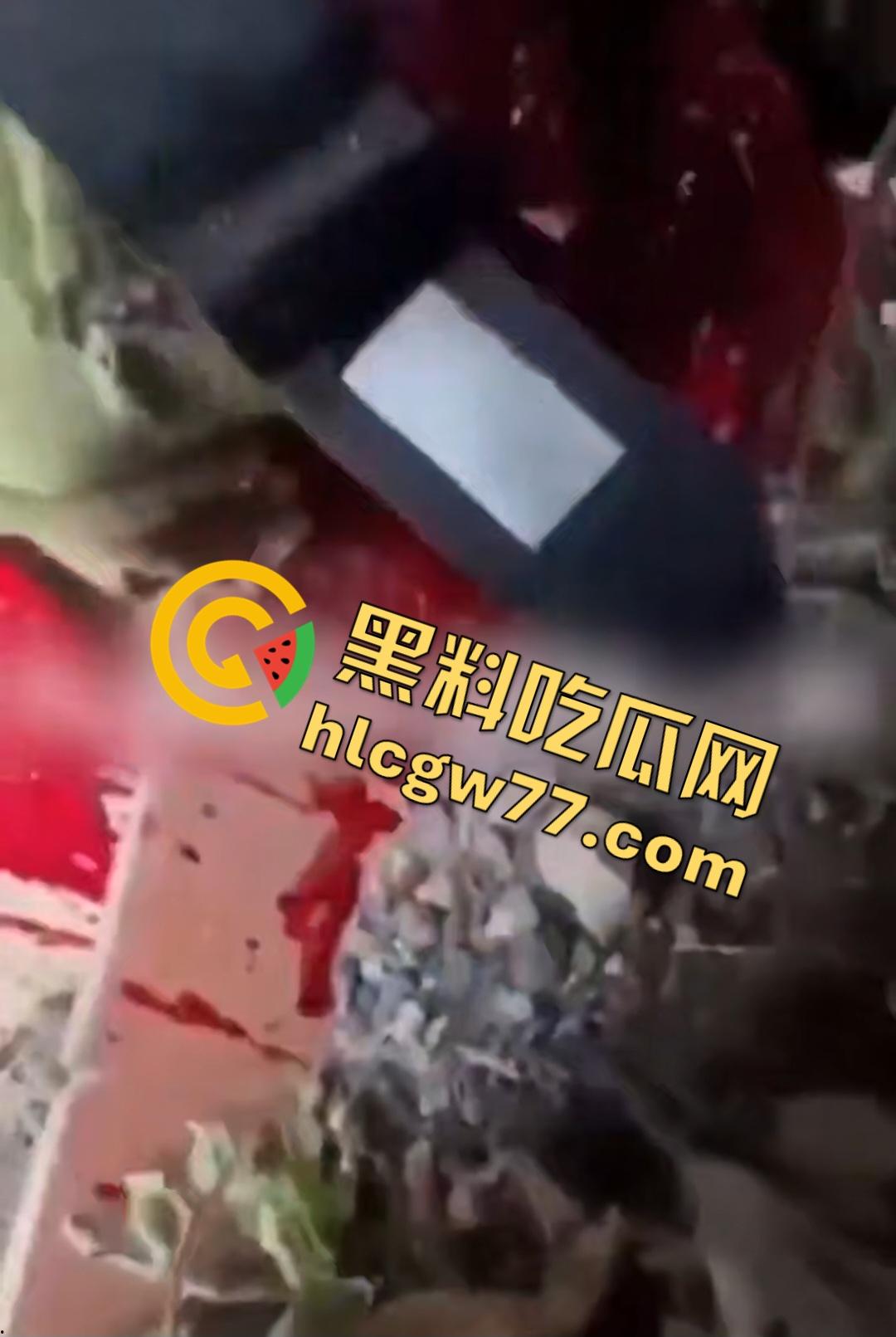 俄乌战场出现食人兵？士兵炸弹炸飞手臂骨髓喷溅，一旁队友饿了还吸食血液充饥！-1