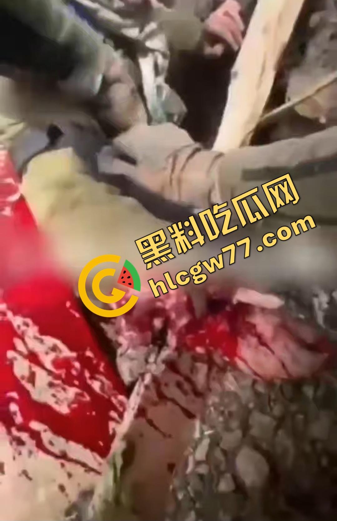 俄乌战场出现食人兵？士兵炸弹炸飞手臂骨髓喷溅，一旁队友饿了还吸食血液充饥！-2
