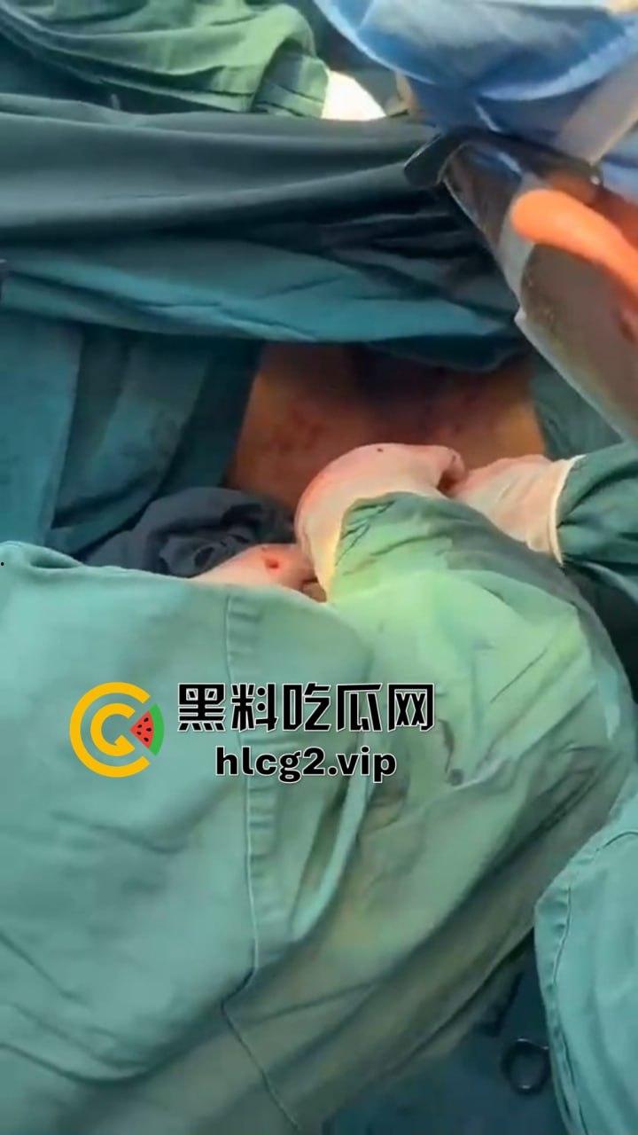 重口慎点！男子硬塞20厘米假体进体内，女子螃蟹夹逼狠整，为了流量太拼了！-10