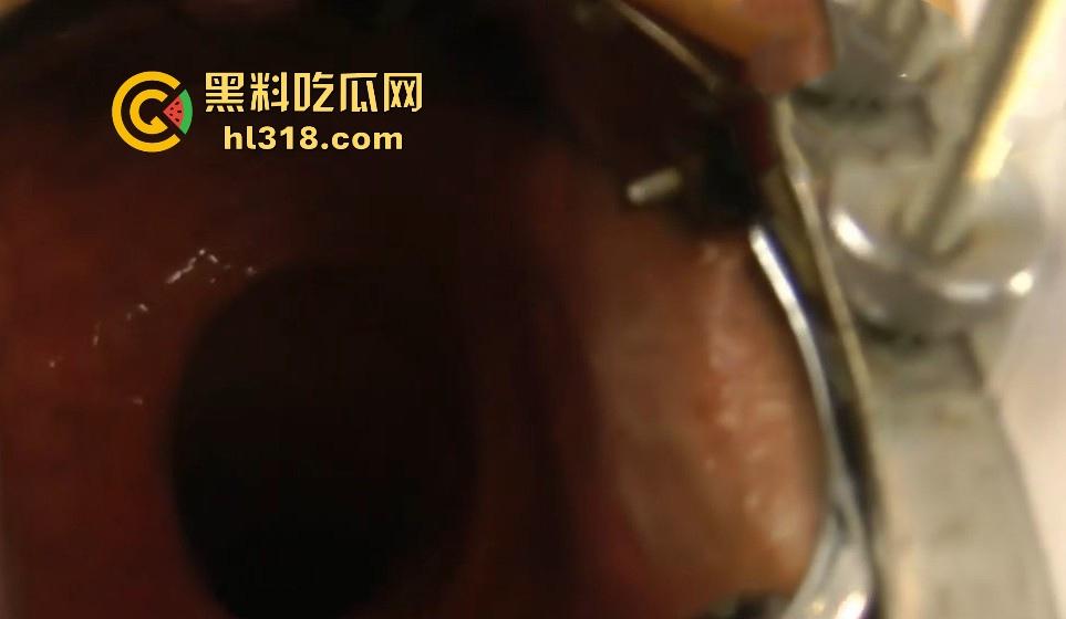 重口慎入!欧美骚妇变态扩肛,超大号道具捅菊花直至小腹隆起,直肠深处清晰呈现,这可真是一步到胃啊!-8