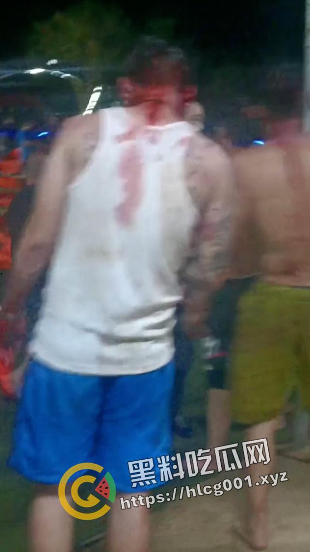 海南海口大致坡大陆人大战海南人  摸了本地人老婆地屁股 命就得留下 现场视频流出 真下死手-4