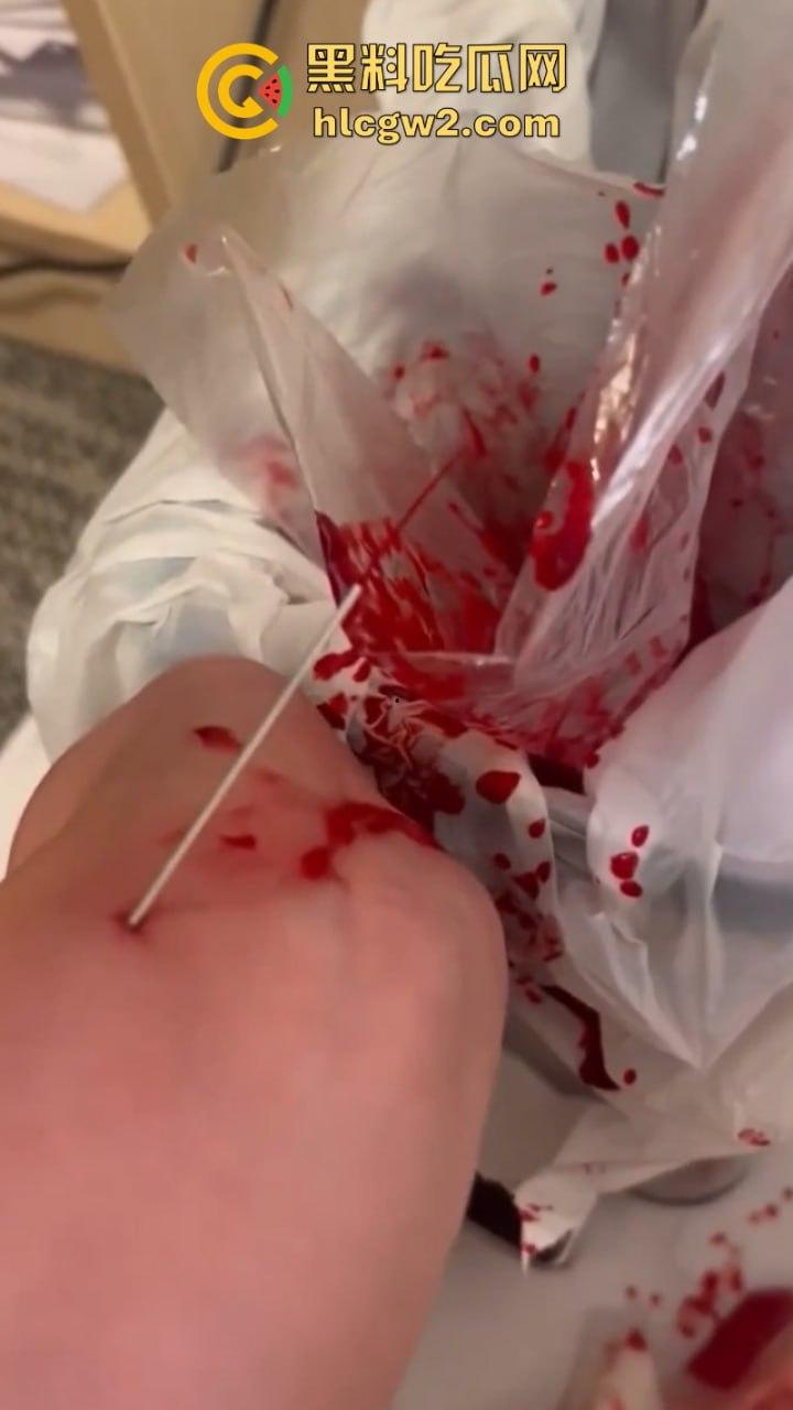 血腥慎入！推特十级脑残血腥自残自拍 残暴割腕引血自流 这是作死还是变态？-2