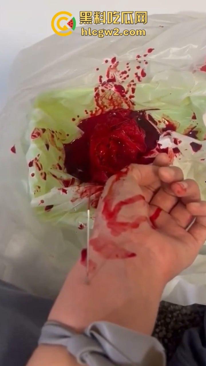 血腥慎入！推特十级脑残血腥自残自拍 残暴割腕引血自流 这是作死还是变态？-6